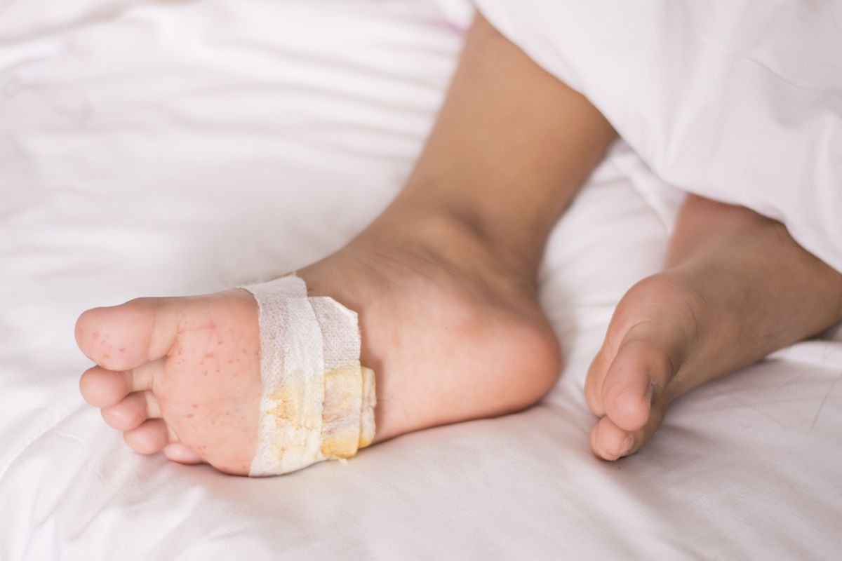 Kenali Luka Diabetes dan Cara Pengobatan yang Aman untuk Cegah Amputasi